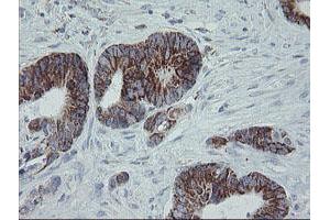 Image no. 15 for anti-Mitochondrial Ribosomal Protein S27 (MRPS27) (AA 151-414) antibody (ABIN1490963)