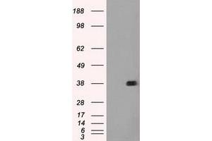 Image no. 3 for anti-Fc gamma RII (CD32) antibody (ABIN1497257) (Fc gamma RII (CD32) anticorps)
