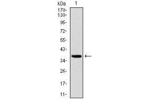 Western blot analysis using FOXO1 mAb against human FOXO1 (AA: 471-600) recombinant protein.