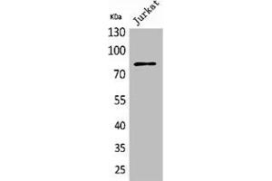 Western Blot analysis of Jurkat cells using PREP Polyclonal Antibody (PREP anticorps  (N-Term))
