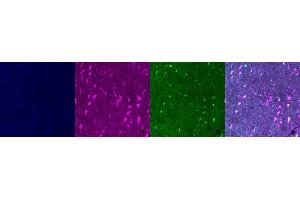 Immunohistochemistry (IHC) image for anti-Interleukin 10 (IL10) antibody (ABIN7456336)