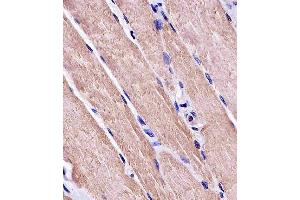 Paraformaldehyde-fixed, paraffin embedded human skeletal muscle, Antigen retrieval by boiling in sodium citrate buffer (pH6.