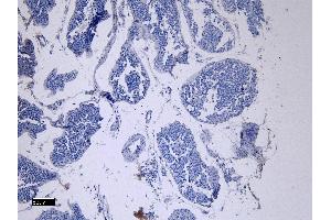 (ABIN7505816) Negative Control showing staining of paraffin embedded Human Testis, with no primary antibody.