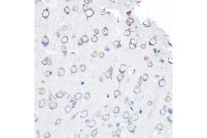 Immunohistochemistry of paraffin-embedded rat brain using [KO Validated] FGF2 Rabbit mAb (ABIN7267184) at dilution of 1:100 (40x lens).
