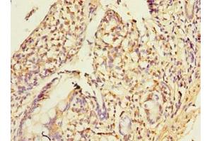 Immunohistochemistry of paraffin-embedded human small intestine tissue using ABIN7155918 at dilution of 1:100 (PLA2G16 anticorps  (AA 1-132))