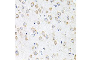 Immunohistochemistry of paraffin-embedded mouse brain using PROK2 antibody (ABIN5975051) at dilution of 1/100 (40x lens). (PROK2 anticorps)