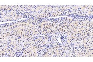 Detection of SIRT3 in Human Kidney Tissue using Polyclonal Antibody to Sirtuin 3 (SIRT3) (SIRT3 anticorps  (AA 126-399))