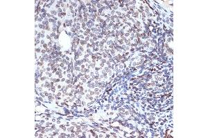 Immunohistochemistry of paraffin-embedded rat ovary using SUN2 Rabbit mAb (ABIN7270135) at dilution of 1:100 (40x lens). (SUN2 anticorps)