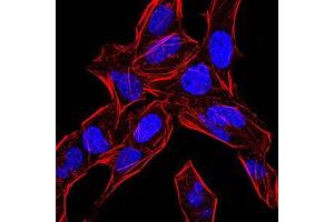 Immunofluorescence analysis of Hela cells using BMP4 mouse mAb. (BMP4 anticorps  (AA 277-408))