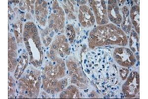 Immunohistochemical staining of paraffin-embedded liver tissue using anti-SERPINA1mouse monoclonal antibody. (SERPINA1 anticorps)