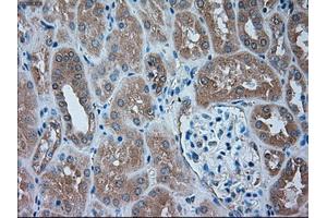 Immunohistochemical staining of paraffin-embedded liver tissue using anti-SERPINA1mouse monoclonal antibody. (SERPINA1 anticorps)