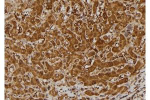 ABIN6269334 at 1/100 staining Human liver tissue by IHC-P.