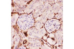 Anti-P Glycoprotein Picoband antibody,  IHC(P): Mouse Kidney Tissue (ABCB1 anticorps  (Middle Region))