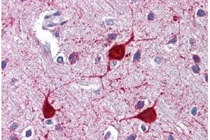 Human Brain, Cortex: Formalin-Fixed, Paraffin-Embedded (FFPE)