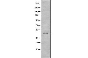 Western blot analysis of MRPL19 using Jurkat whole cell lysates (MRPL19 anticorps  (Internal Region))