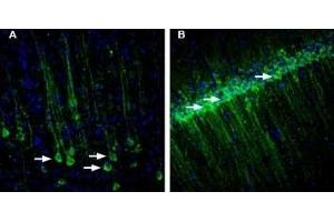 Expression of RAMP1 in rat brain - Immunohistochemical staining of rat free-floating frozen section using Anti-RAMP1 (extracellular) Antibody (ABIN7043595, ABIN7045219 and ABIN7045220).