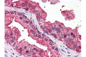 anti-DNA-Damage Regulated Autophagy Modulator 1 (DRAM1) (N-Term) antibody