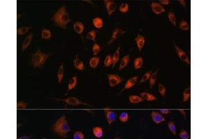 Immunofluorescence analysis of L929 cells using TRIM4 Polyclonal Antibody at dilution of 1:100. (TRIM4 anticorps)