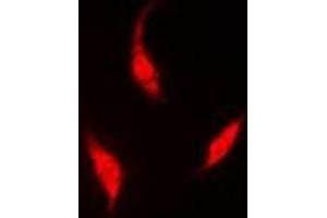 Immunofluorescent analysis of HIWI2 staining in A549 cells. (PIWIL4 anticorps)