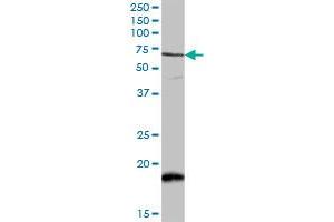CAMKK2 MaxPab rabbit polyclonal antibody. (CAMKK2 anticorps  (AA 1-541))