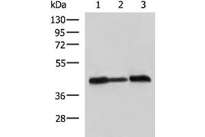 Western blot analysis of A549 Hela and HepG2 cell lysates using PDHA1 Polyclonal Antibody at dilution of 1:750 (PDHA1 anticorps)