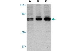 Western blot analysis of PTK7 in (A) human, (B) mouse and (C) rat colon tissue lysate with PTK7 polyclonal antibody  at 1 ug/mL .