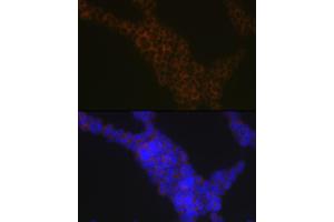 Immunofluorescence analysis of Jurkat cells using LSP1 Rabbit mAb (ABIN7268319) at dilution of 1:100 (40x lens).