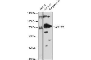 Western blot analysis of extracts of various cell lines, using ZNF460 antibody (ABIN7271490) at 1:1000 dilution. (ZNF460 anticorps  (AA 100-210))