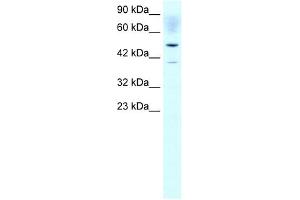 ACAT2 antibody used at 1 ug/ml to detect target protein. (ACAT2 anticorps)