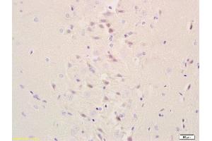 Formalin-fixed and paraffin embedded rat brain tissue labeled with Anti-Galc Polyclonal Antibody, Unconjugated at 1:200 followed by conjugation to the secondary antibody, (SP-0023), and DAB staining