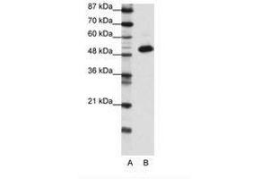 Image no. 1 for anti-Transcriptional Adaptor 3 (TADA3) (N-Term) antibody (ABIN6736139) (TADA3L anticorps  (N-Term))