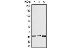 Western blot analysis of APJ expression in HeLa (A), mouse lung (B), rat liver (C) whole cell lysates. (Apelin Receptor anticorps  (Center))