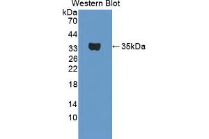 Western blot analysis of the recombinant protein. (TPSB2 anticorps  (AA 30-276))