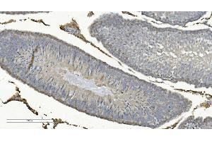 anti-Cytochrome C Oxidase Subunit VIIIA (Ubiquitous) (COX8A) (C-Term) antibody