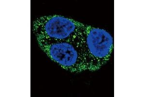 Immunofluorescence (IF) image for anti-Tyrosinase (TYR) antibody (ABIN3003157) (TYR anticorps)