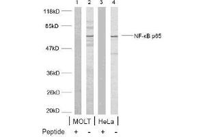 Image no. 1 for anti-Nuclear Factor-kB p65 (NFkBP65) (Ser468) antibody (ABIN197114) (NF-kB p65 anticorps  (Ser468))