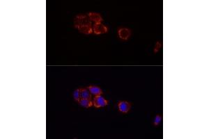 Immunofluorescence analysis of HepG2 cells using Perilipin-2 antibody (ABIN7269220) at dilution of 1:100 (40x lens). (ADRP anticorps)