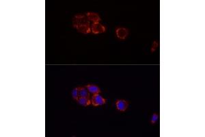 Immunofluorescence analysis of HepG2 cells using Perilipin-2 antibody (ABIN7269220) at dilution of 1:100 (40x lens).