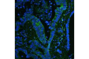 IF analysis of GPX1 using anti-GPX1 antibody (ABIN6719520). (Glutathione Peroxidase 1 anticorps  (Middle Region))