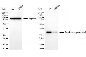 Western blotting analysis using replication protein A2 antibody (ABIN7800174). (Recombinant RPA2 anticorps)