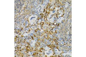Immunohistochemistry of paraffin-embedded mouse spleen using CD117/c-Kit antibody (ABIN6133454, ABIN6142896, ABIN6142898 and ABIN6213818) at dilution of 1:150 (40x lens).