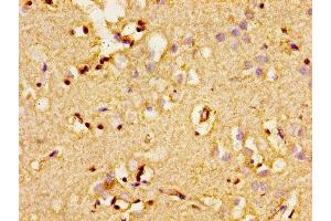 Immunohistochemistry of paraffin-embedded human brain tissue using ABIN7143338 at dilution of 1:100 (ADCY8 anticorps  (AA 534-670))