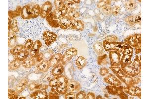 ABIN6266223 and ABIN6277374 at 1/100 staining human normal kidney tissue by IHC-P. (Gelsolin anticorps  (C-Term))