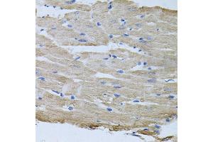 Immunohistochemistry of paraffin-embedded rat heart using TARS antibody (ABIN6132713, ABIN6148858, ABIN6148859 and ABIN6222758) at dilution of 1:100 (40x lens). (TARS anticorps  (AA 1-230))