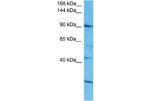 Host:  Rabbit  Target Name:  SALL4  Sample Tissue:  Human 721_B Whole Cell  Antibody Dilution:  1ug/ml