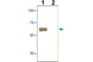 The whole cell lysate derived from LNCaP was immunoblotted by SOX9 polyclonal antibody  at 1 : 500 (Lane 1), Lane 2 is a negative control. (SOX9 anticorps)