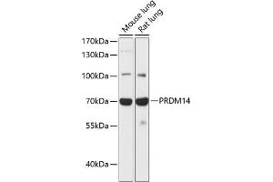 Western blot analysis of extracts of various cell lines, using PRDM14 antibody (ABIN6128495, ABIN6146132, ABIN6146135 and ABIN6217736) at 1:1000 dilution. (PRDM14 anticorps  (AA 1-260))
