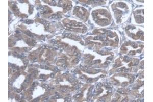 Detection of TST in Mouse Stomach Tissue using Polyclonal Antibody to Thiosulfate Sulfurtransferase (TST)