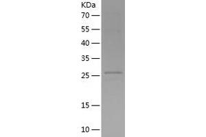 Western Blotting (WB) image for CD80 (CD80) (AA 35-242) protein (His tag) (ABIN7122214)