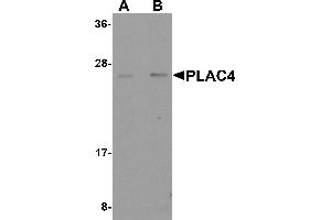 Western Blotting (WB) image for anti-Placenta-Specific 4 (PLAC4) (Middle Region) antibody (ABIN1031043)